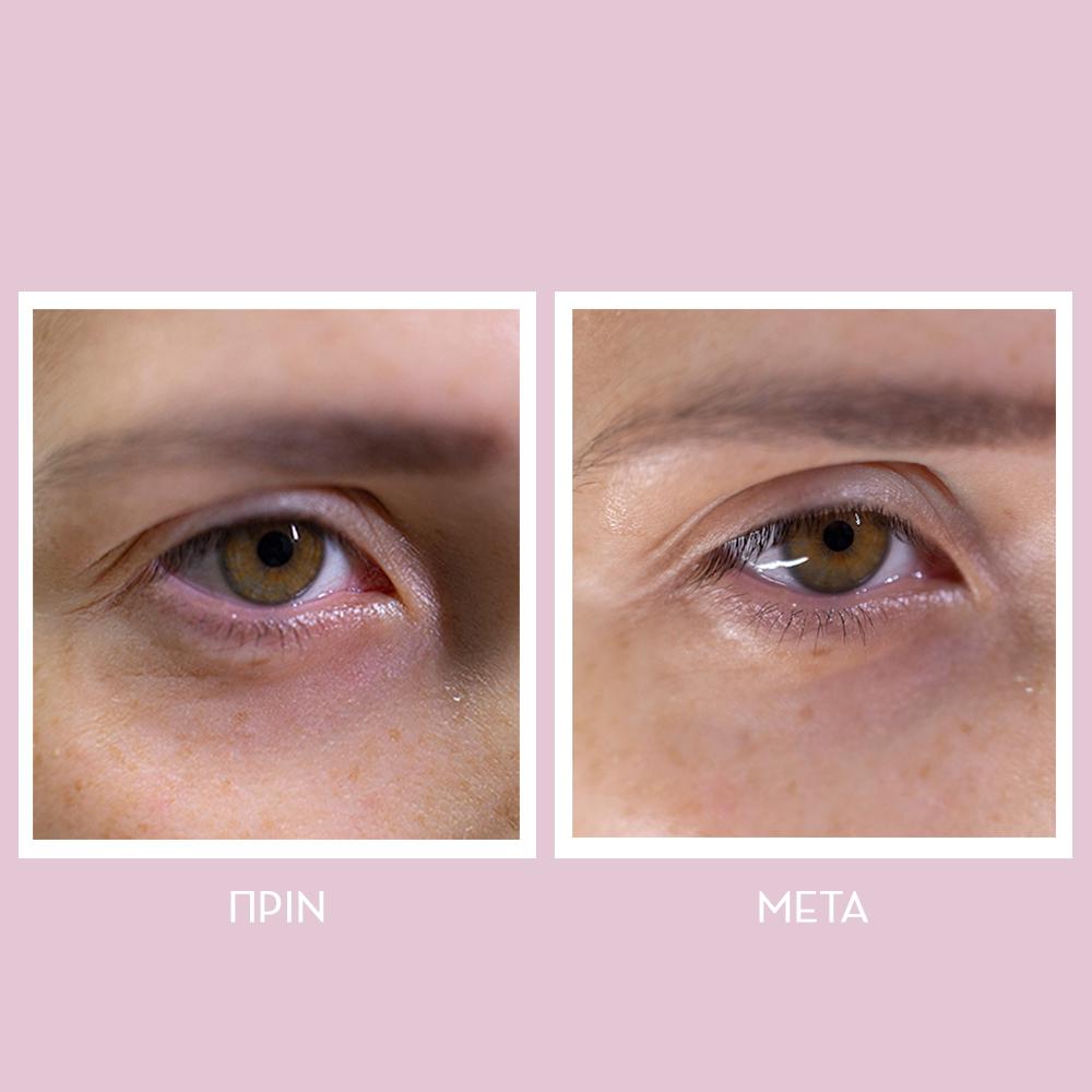 Peptides Spring Hydra-Gel Eye Patches - 60 τμχ.